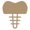 インプラント